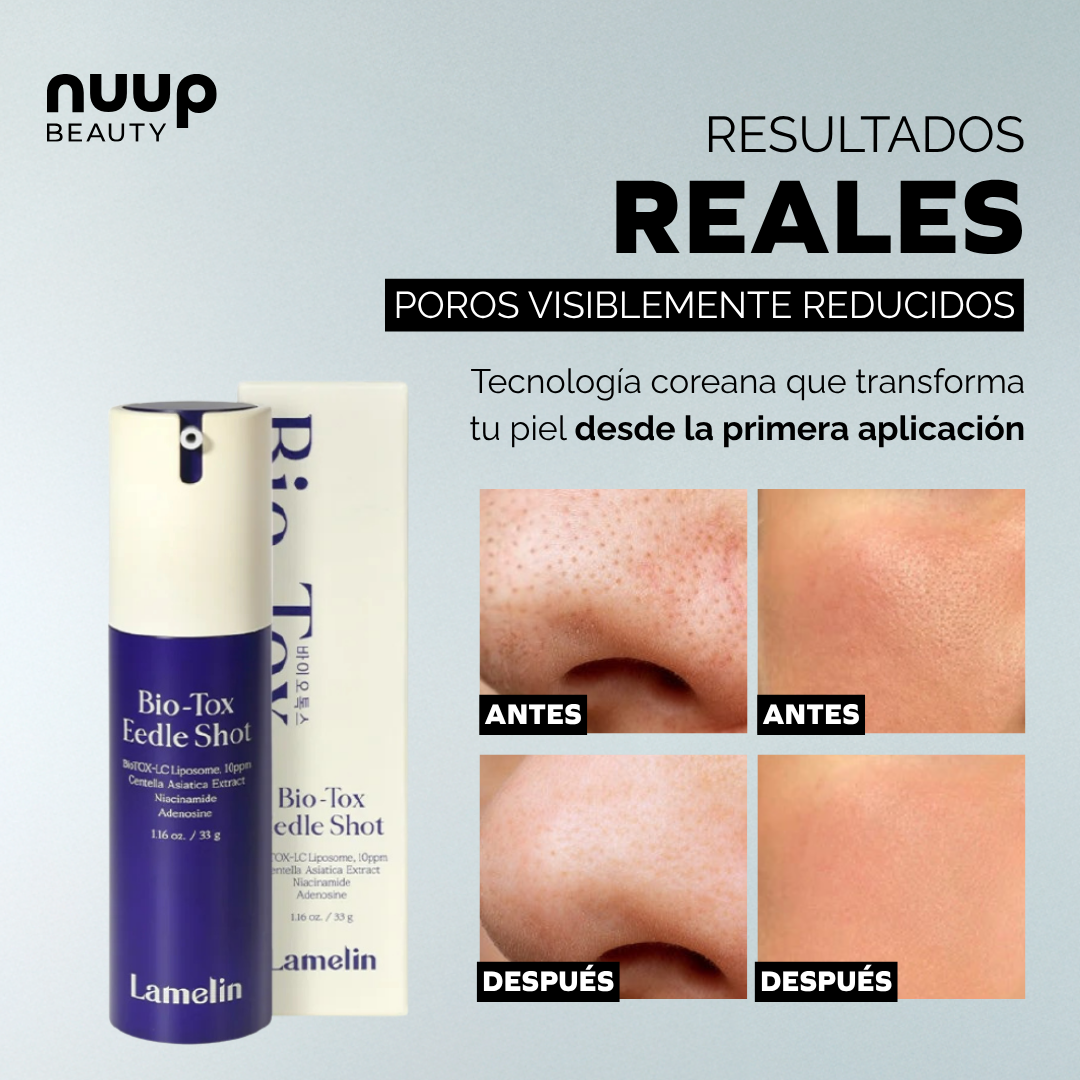 Lamelin Bio-Tox Eedle Shot – Nuup Beauty Lamelin Bio-Tox Eedle Shot – Nuup Beauty