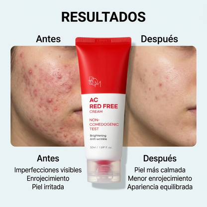 B.O.M. AC Red Free Cream