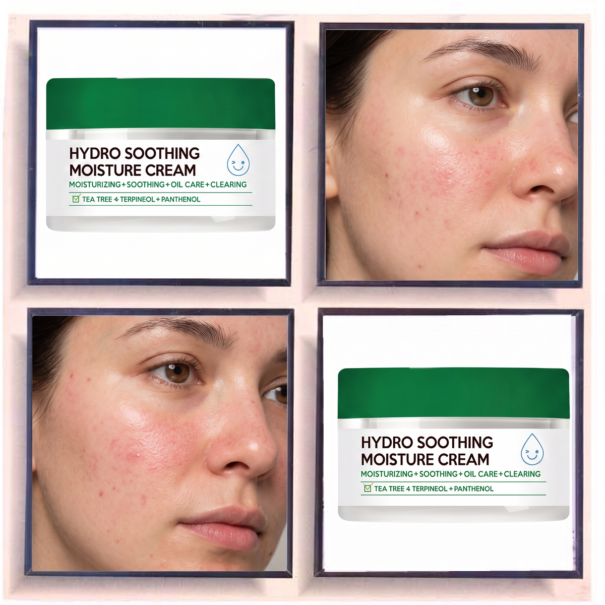 Troubless Hydro Soothing Moisture Cream