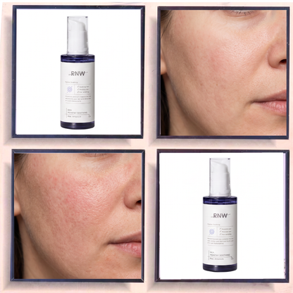 RNW DER MOISTAY Soothing Real Ampoule