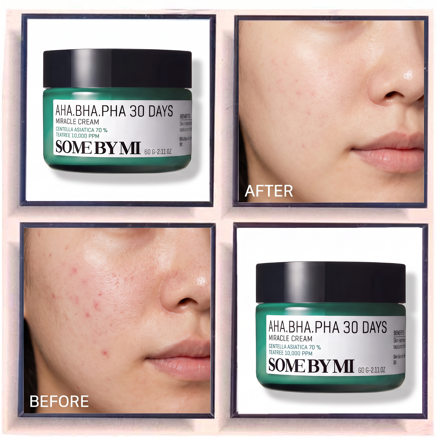 Some By Mi AHA-BHA-PHA 30 Days Miracle Cream
