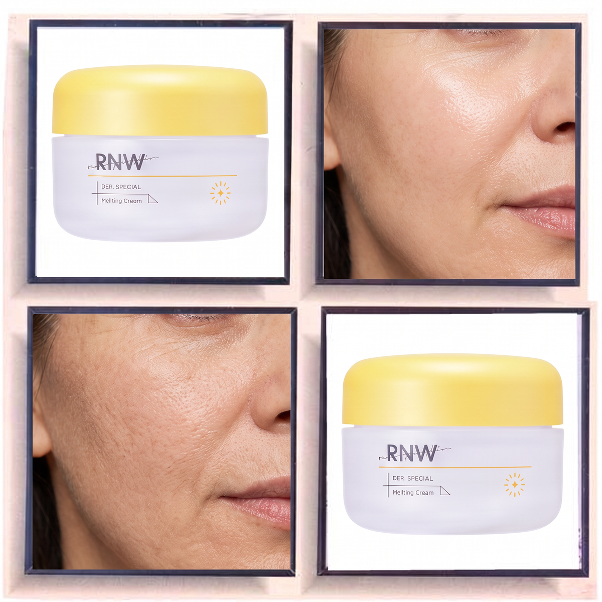 RNW DER. SPECIAL Melatoc Cream