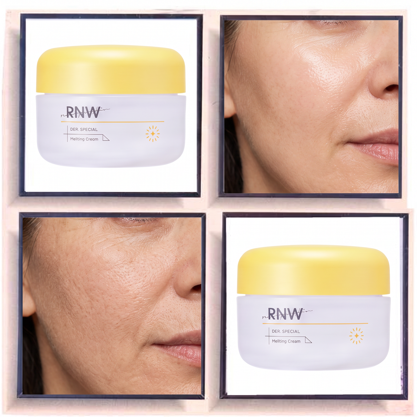RNW DER. SPECIAL Melatoc Cream