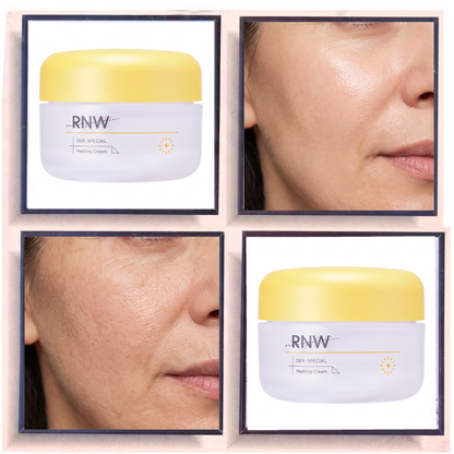 RNW DER. SPECIAL Melatoc Cream