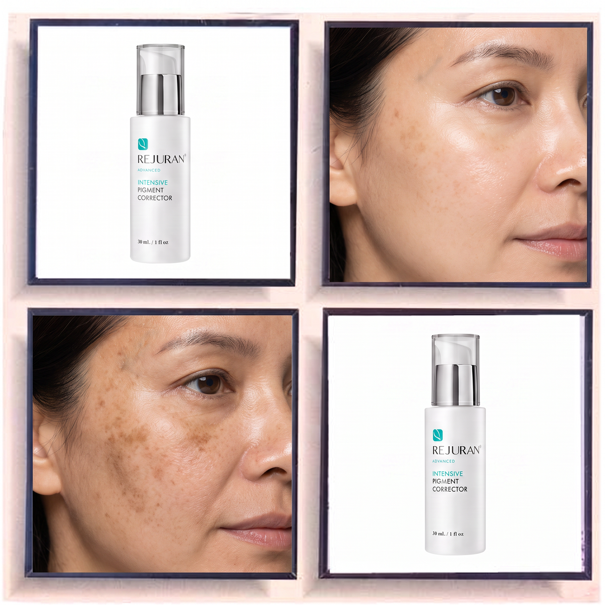 Rejuran Advanced Intense Pigment Corrector