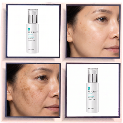 Rejuran Advanced Intense Pigment Corrector