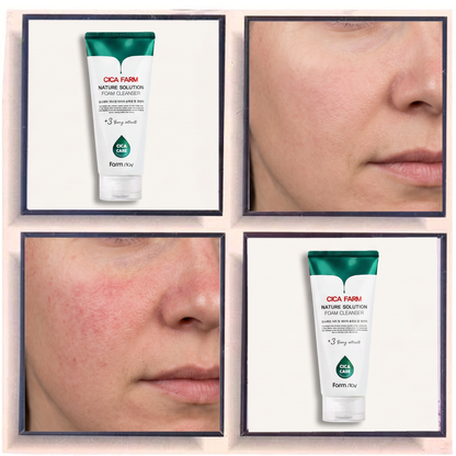 Farmstay Cica Farm Acne Foam Cleanser