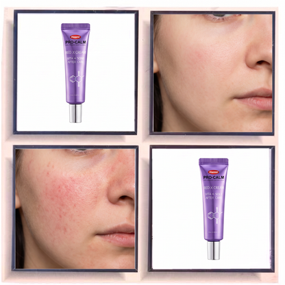 Hanmi Pro-Calm Red X Cream S Vita-K Some After Care