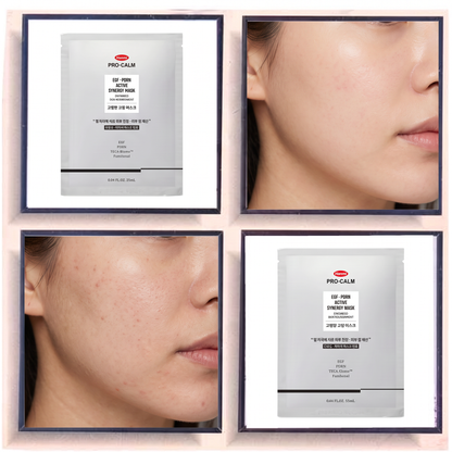 Hanmi Pro-Calm EGF PDRN Active Synergy Mask