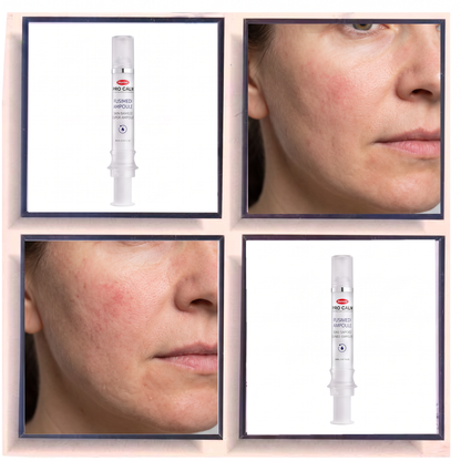 Hanmi Pro-Calm Fusidemi Repair Shout Ampoule S Repairing Skin Barrier