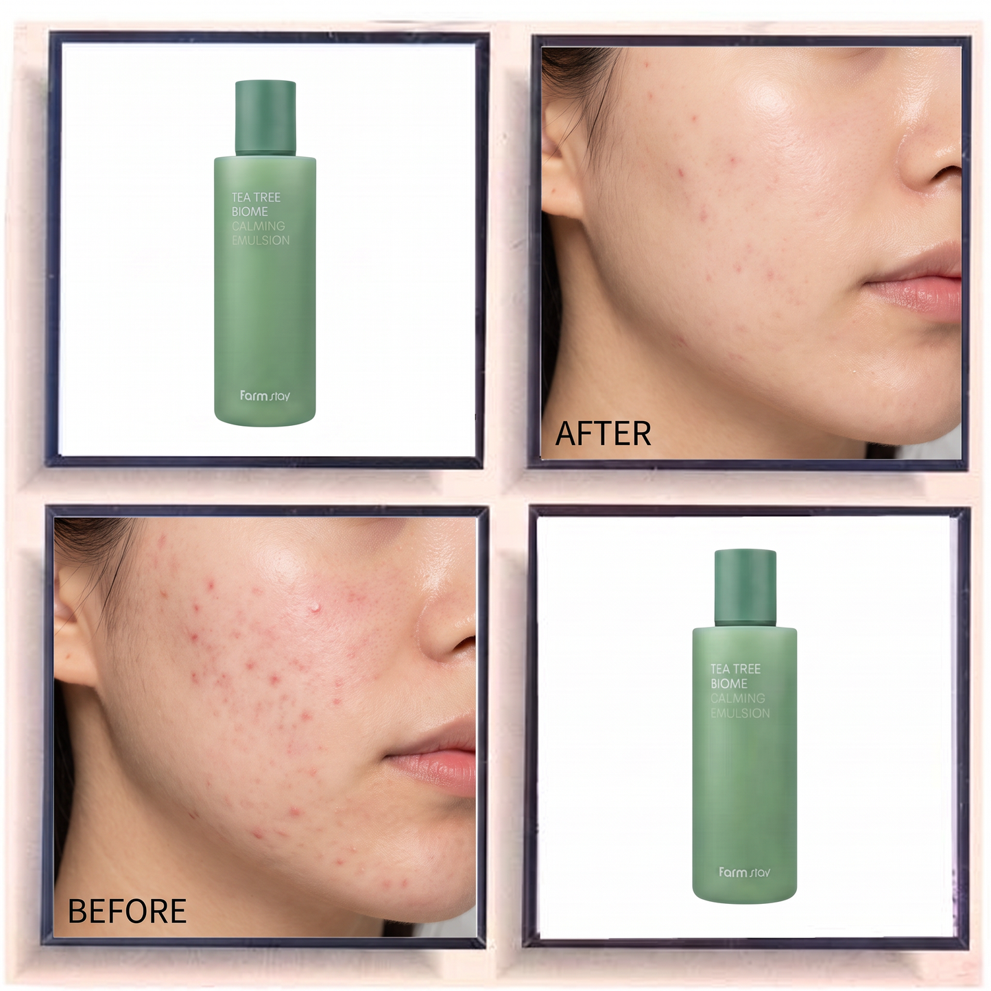 Farmstay Tea Tree Biome Calming Emulsion