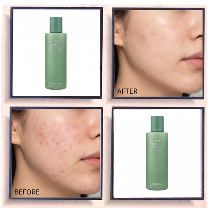 Farmstay Tea Tree Biome Calming Emulsion