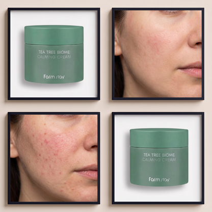 Farmstay Tea Tree Biome Calming Cream