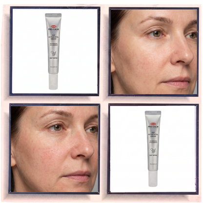 Hanmi Pro-Calm EGF Active Vital Cream 10PPM