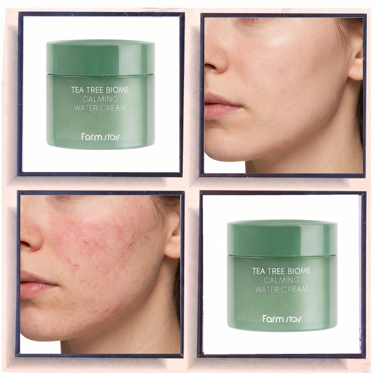 Farmstay Tea Tree Biome Calming Water Cream
