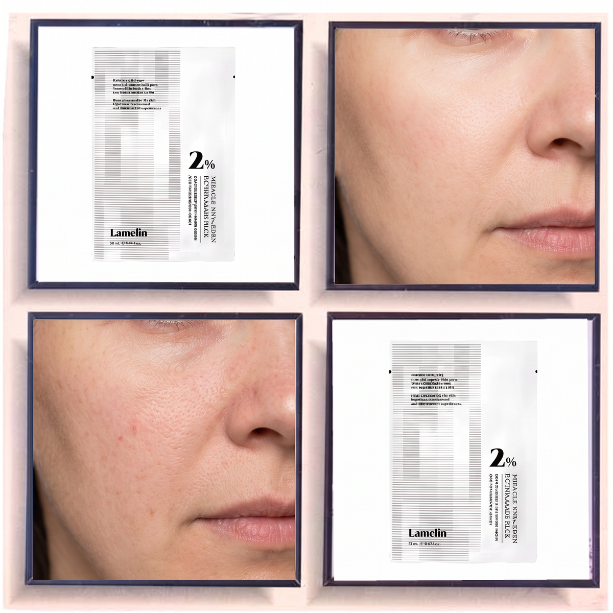 Lamelin Miracle NMN+PDRN Biotox Mask
