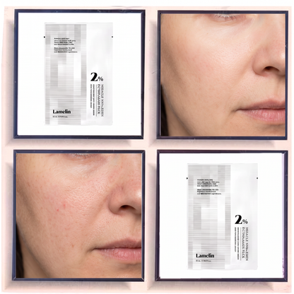 Lamelin Miracle NMN+PDRN Biotox Mask