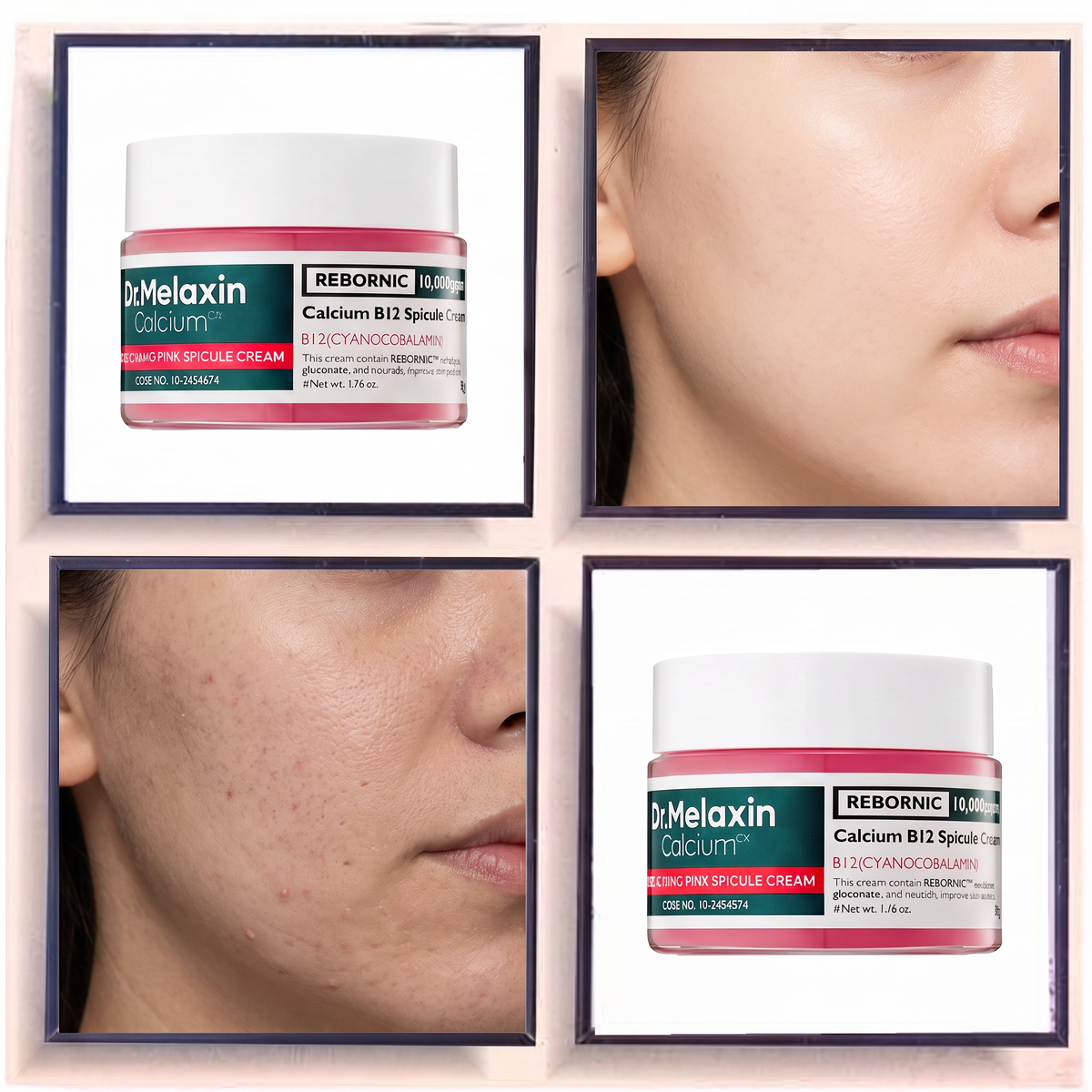 Dr. Melaxin Calcium CX Cyano Pink Spicule Cream
