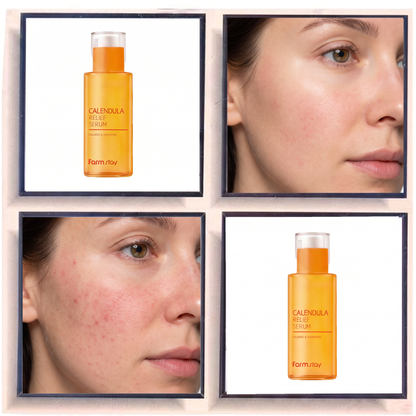 Farmstay Calendula Relief Serum