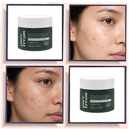 Lamelin Arbutin Pure Cream