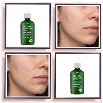 Farmstay Cica Farm Blemish Clear Ampoule
