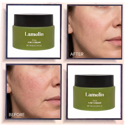 Lamelin Cica 4 In 1 Cream