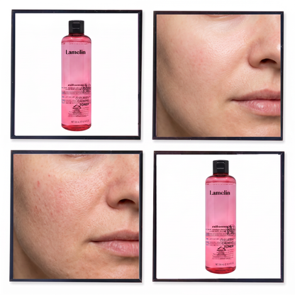 Lamelin Collagen Calming Toner