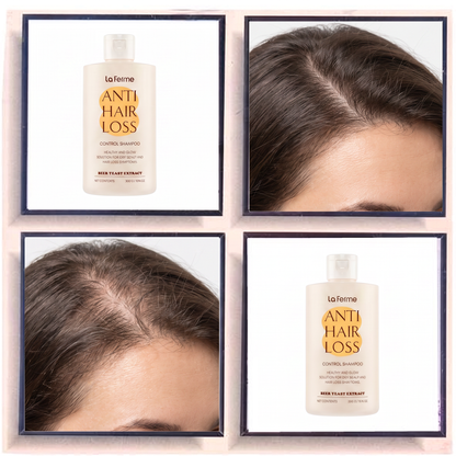 La Ferme Anti Hair Loss Control Shampoo