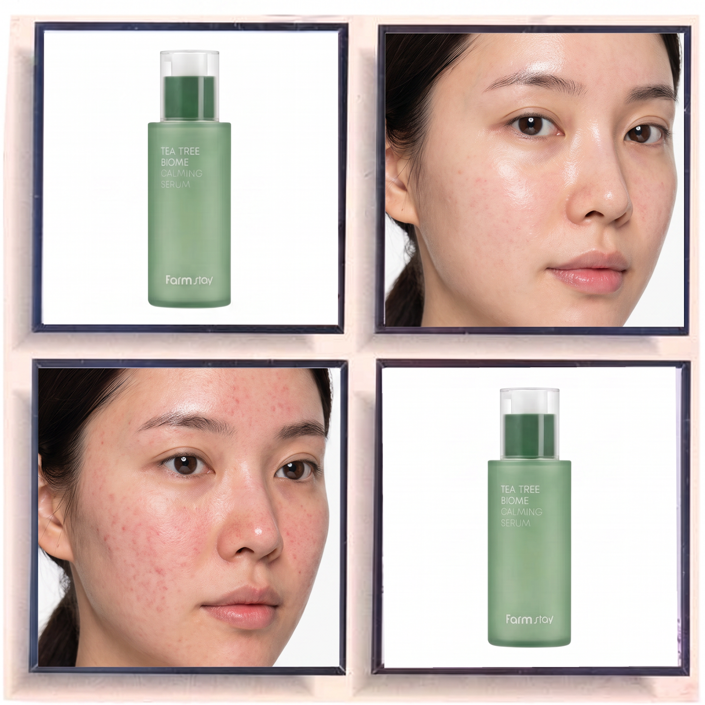 Farmstay Tea Tree Biome Calming Serum