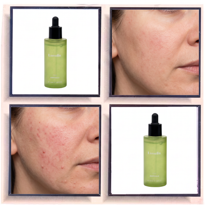 Lamelin Cica Ampoule