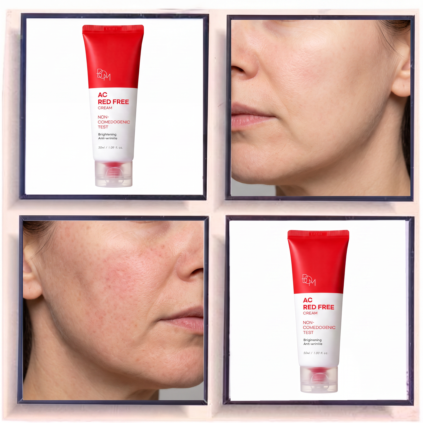 B.O.M. AC Red Free Cream