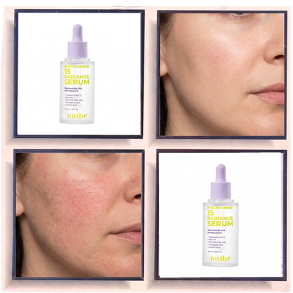 Nuibe Niacinamide 15 Radiance Serum