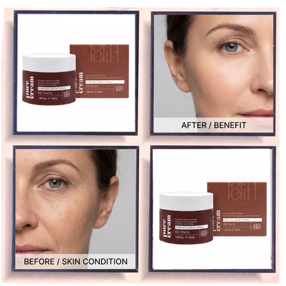 Lamelin Retinol Pure Cream